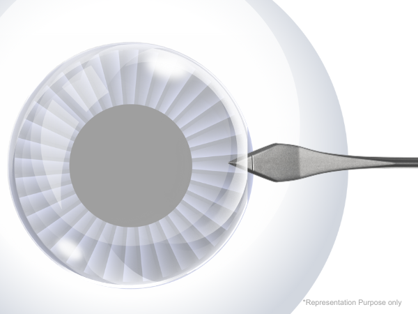 Acucut Safety Slit Blade & Keratome Blades (Single)