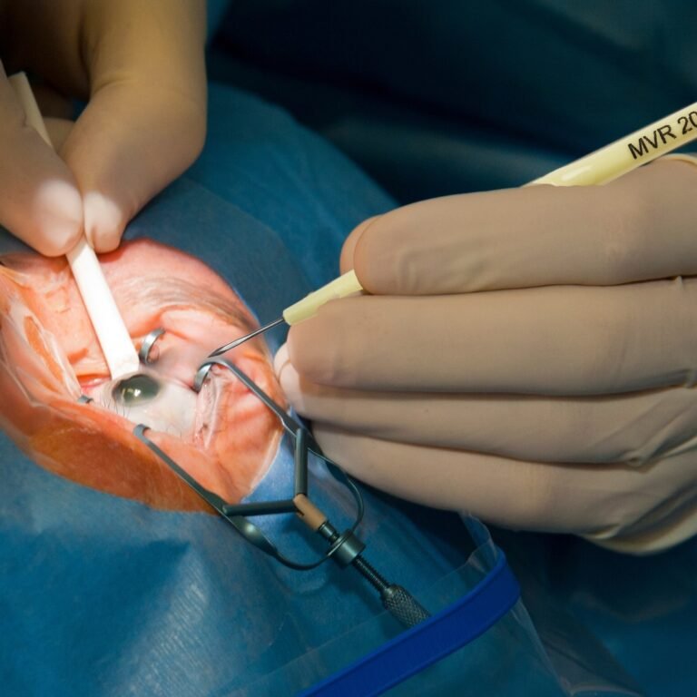 Why MVR Blades Are Essential for Ophthalmic Surgery